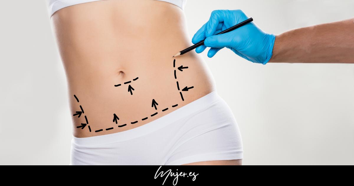 Aesthetic treatments do not work miracles: myths and some truths about cellulite, laser hair removal and localized fat