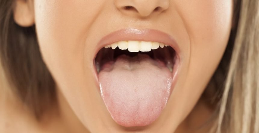 Body FAQ: What Does It Mean When Your Tongue Turns White?